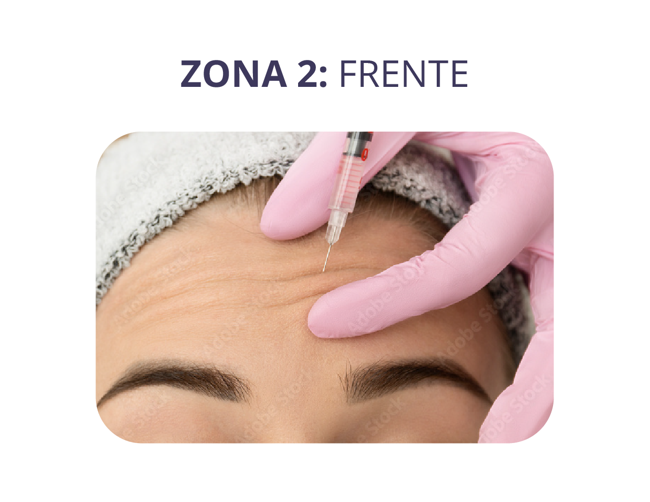 zonas landing relleno_frente.png