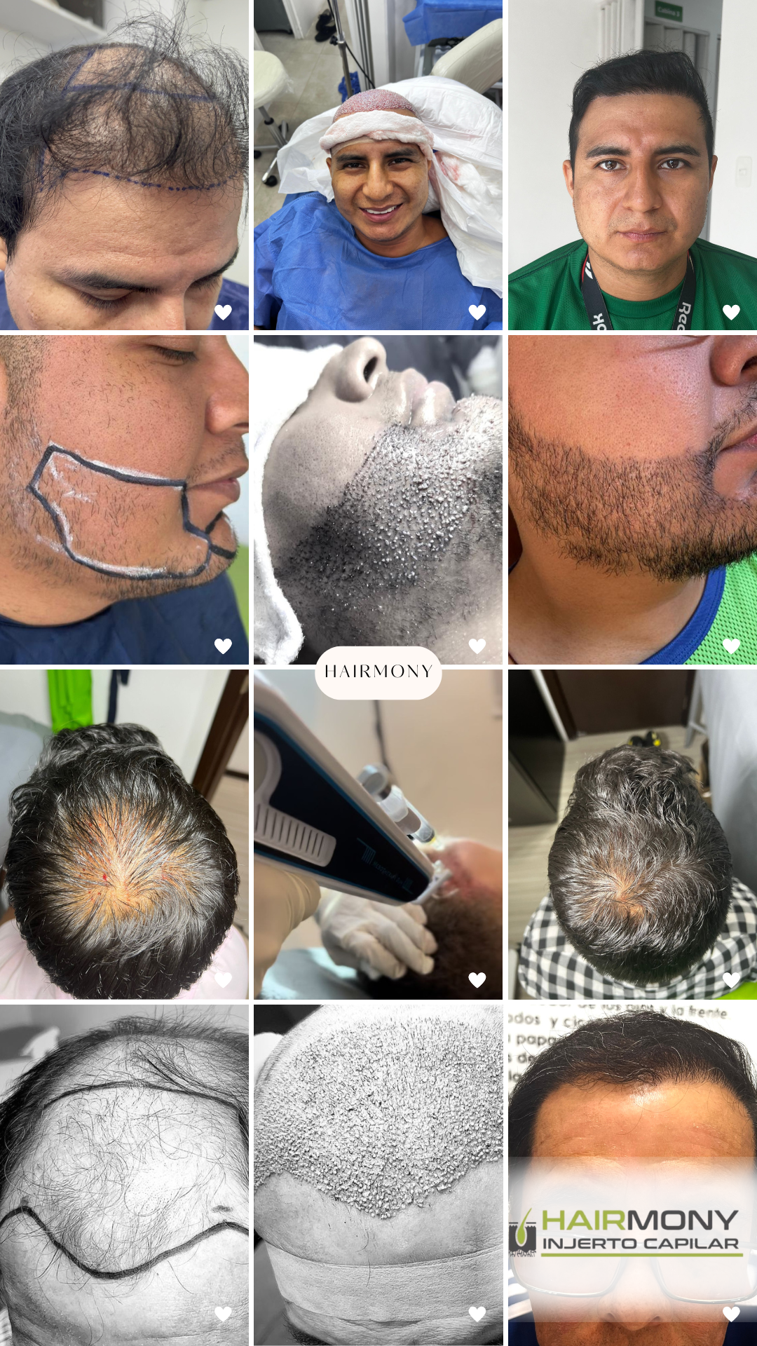 Instagram Story Collage recap minimalista 2023.png