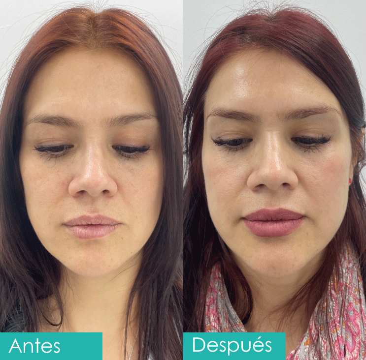 Foto_antes_despues.png