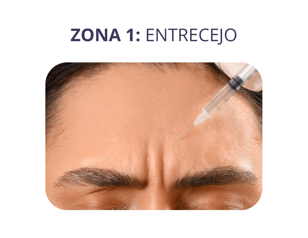 zonas landing relleno_entrecejo.png